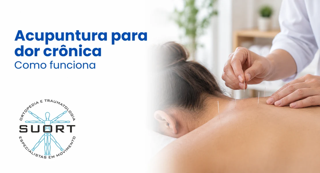 Acupuntura para dor crônica com base científica, integrada à fisioterapia e à ortopedia com convênio em Perdizes, São Paulo