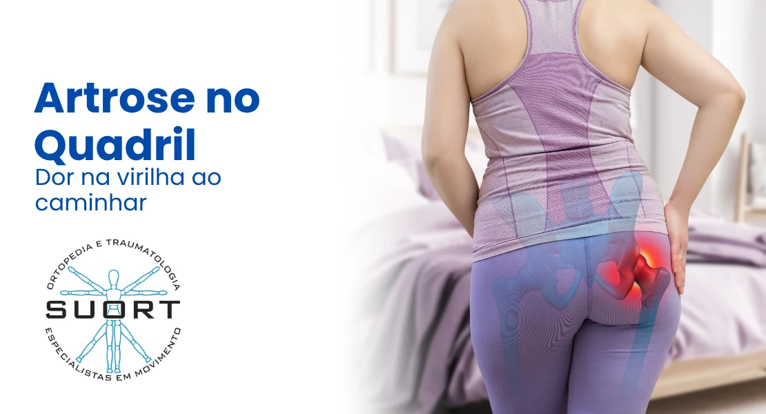 Artrose no quadril (coxartrose), tratamento da dor na virilha com ortopedista e fisioterapia com convênio em Perdizes, São Paulo