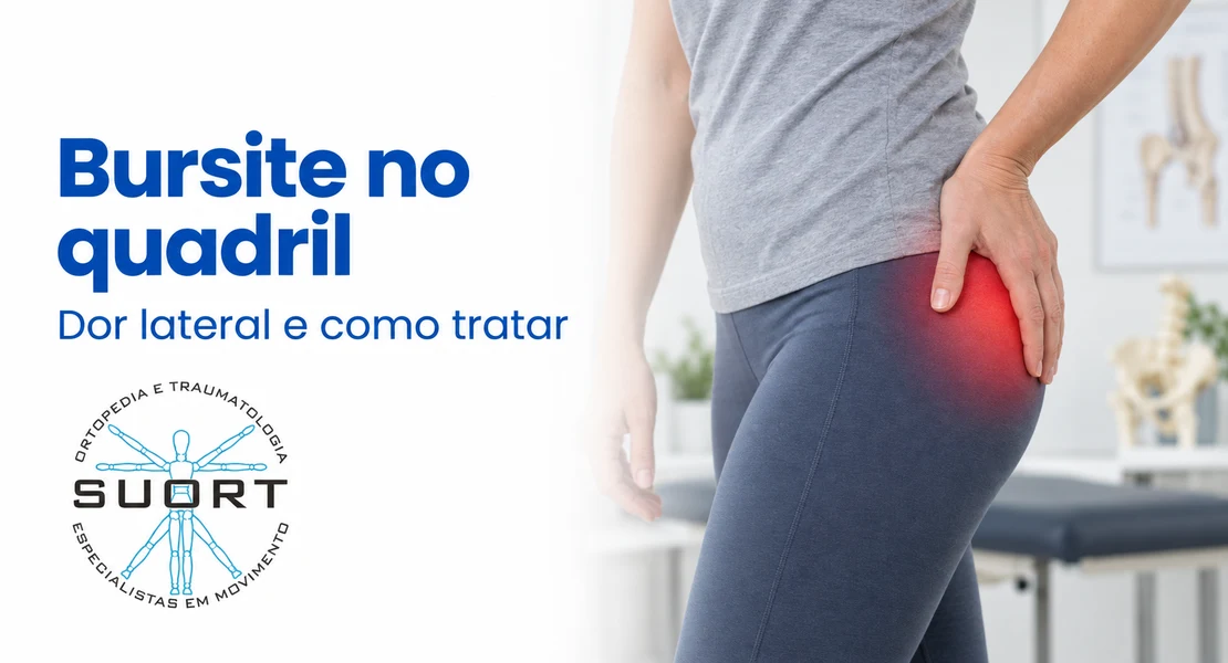 Bursite no quadril (bursite trocantérica), tratamento da dor lateral com ortopedista e fisioterapia com convênio em Perdizes, São Paulo