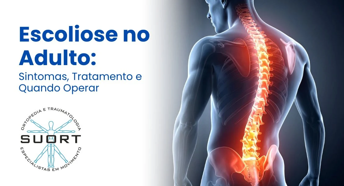Escoliose no adulto — tratamento com fisioterapia, RPG e avaliação ortopédica na SUORT Clínica Integrada, Perdizes, São Paulo