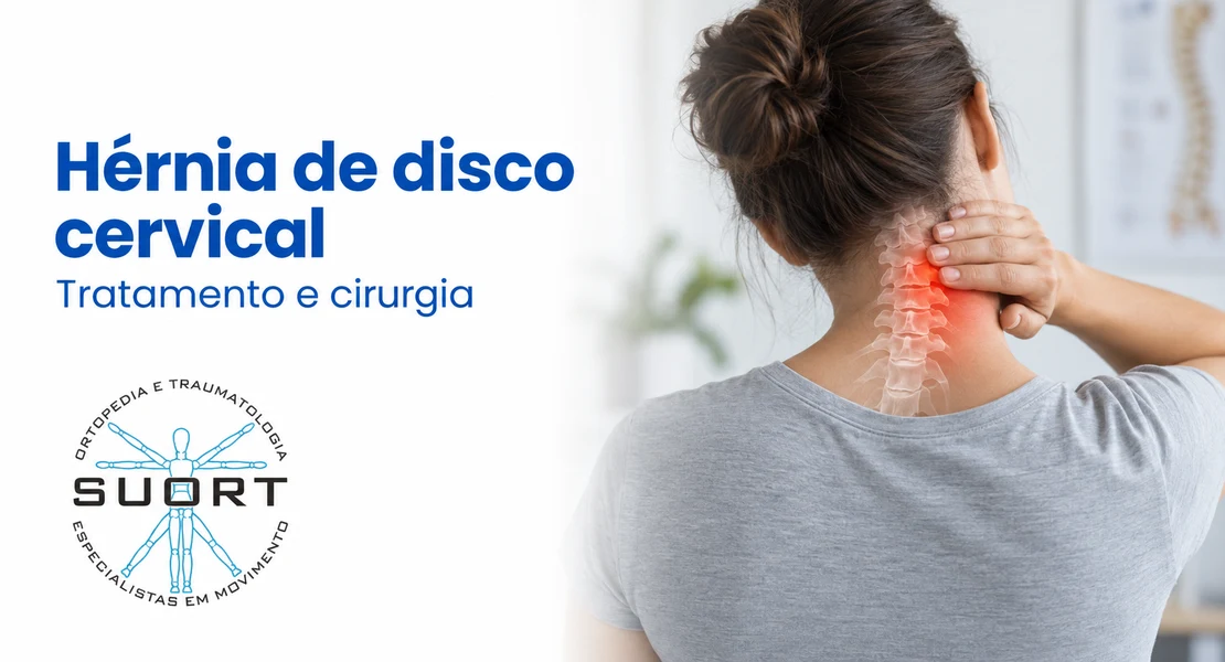 Hérnia de disco cervical, tratamento conservador e quando operar, com ortopedista e convênio em Perdizes, São Paulo