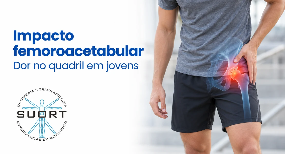 Impacto femoroacetabular, dor na virilha em jovens e atletas, tratamento com ortopedista e fisioterapia com convênio em Perdizes, São Paulo