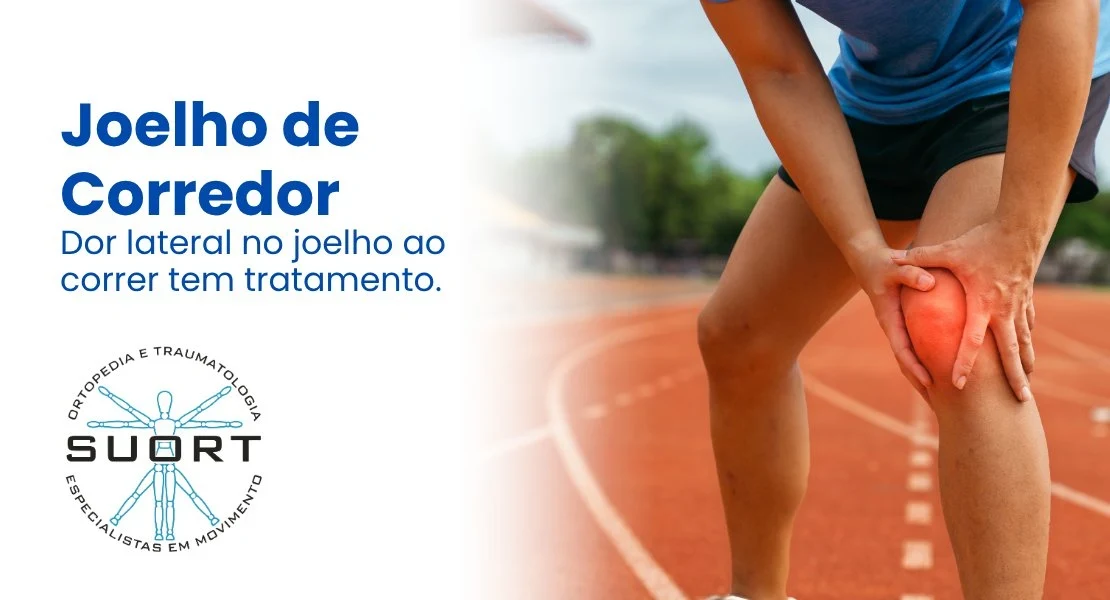Corredora com dor lateral no joelho, síndrome da banda iliotibial, tratamento com fisioterapia e convênio na SUORT Clínica Integrada, Perdizes, São Paulo