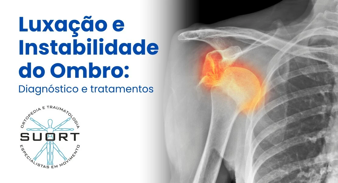 Luxação e instabilidade do ombro — diagnóstico e tratamento com Dr. Sérgio Rovinski na SUORT Clínica Integrada, Perdizes, São Paulo