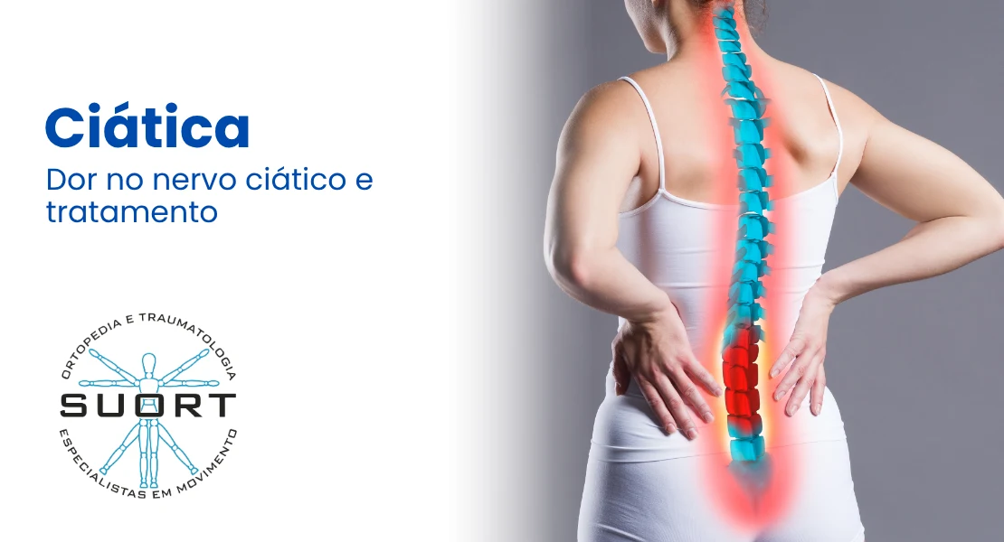 Dor no nervo ciático (ciática), tratamento com ortopedista e fisioterapia com convênio em Perdizes, São Paulo