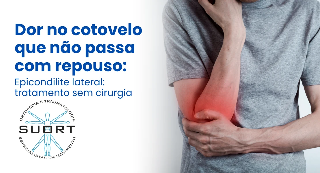 Pé com dor que queima entre os dedos — Neuroma de Morton tratamento ortopédico SUORT Clínica Integrada Perdizes São Paulo