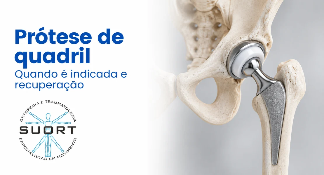 Prótese de quadril (artroplastia total), indicação, satisfação e recuperação com ortopedista e fisioterapia com convênio em Perdizes, São Paulo