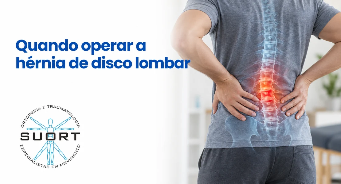 Quando operar hérnia de disco lombar, indicações reais na dor ciática, com ortopedista e convênio em Perdizes, São Paulo