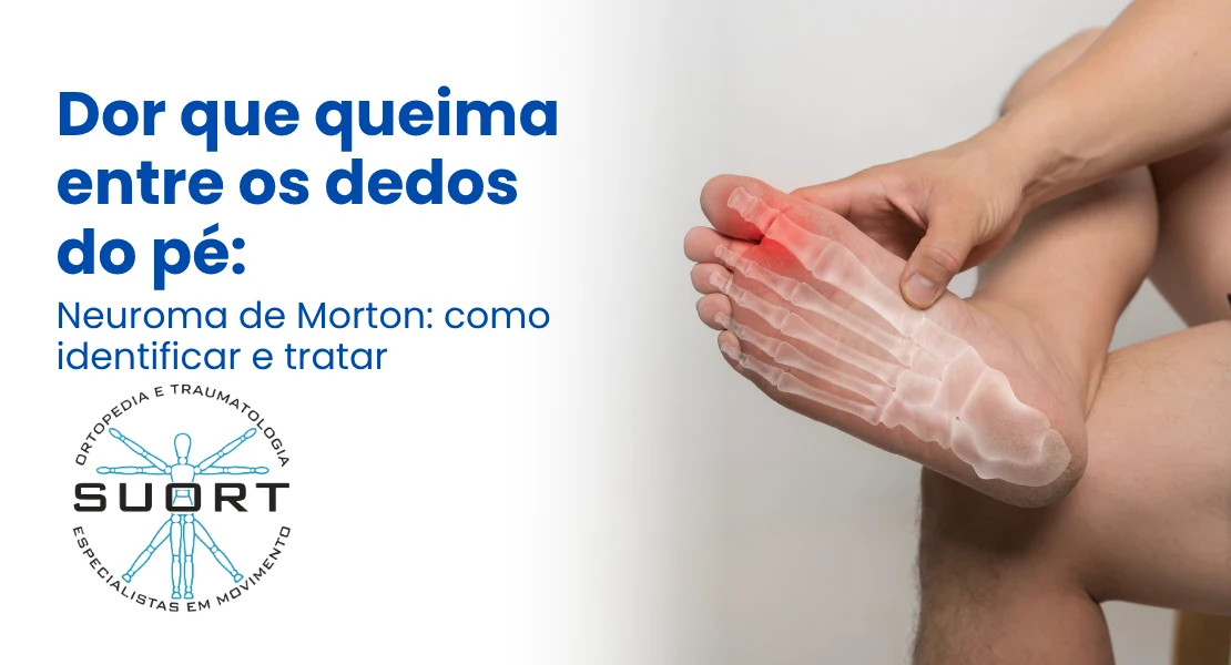 Mão com dor na base do polegar e pulso — tenossinovite de De Quervain tratamento ortopédico SUORT Clínica Integrada Perdizes São Paulo